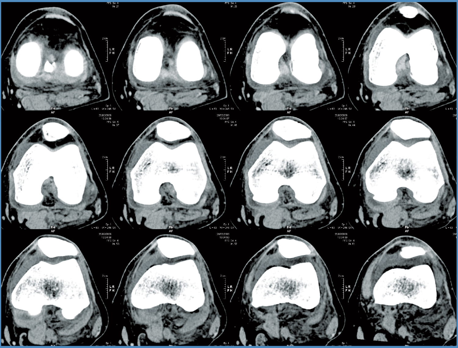 x-ray Images of a Knee