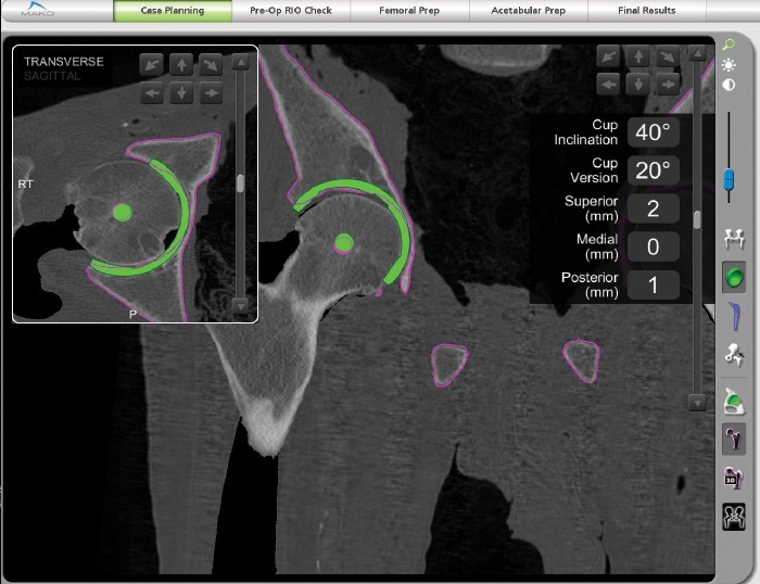 Mako Imaging